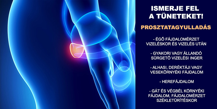 A prostatitis fájdalom szindróma kezelése